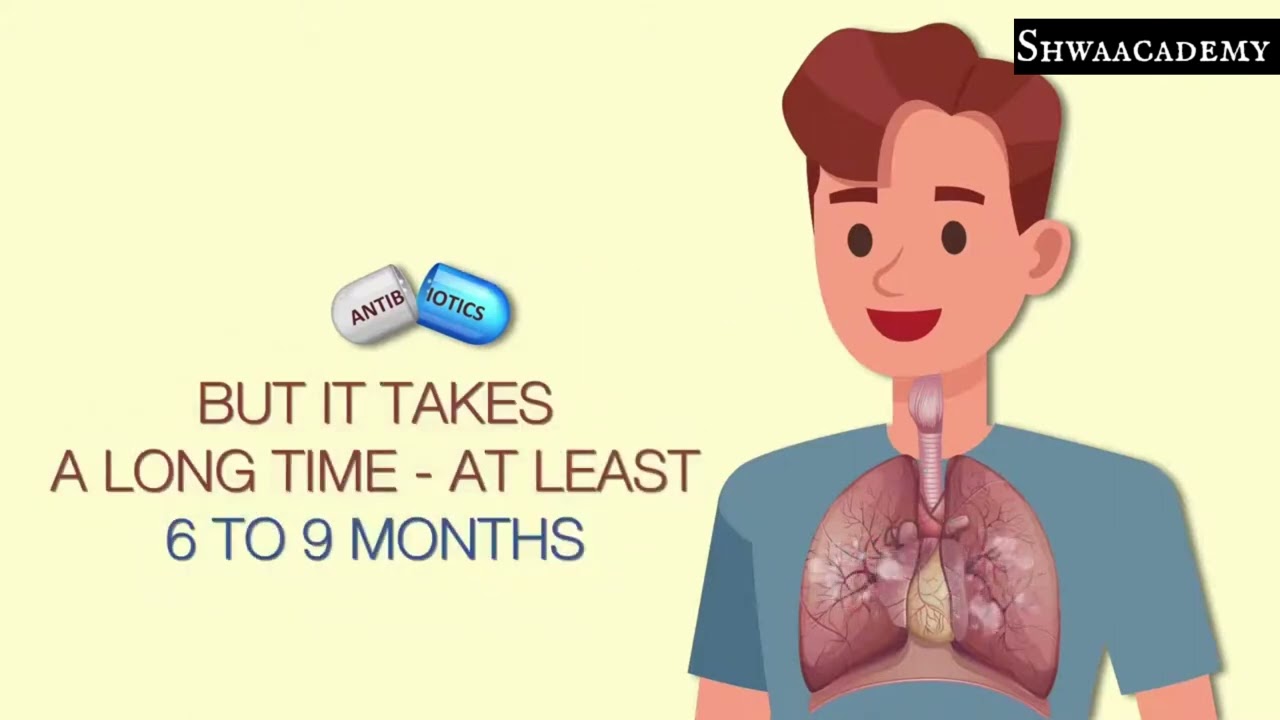 Что такое туберкулез (ТБ): симптомы, причины, диагностика и лечение