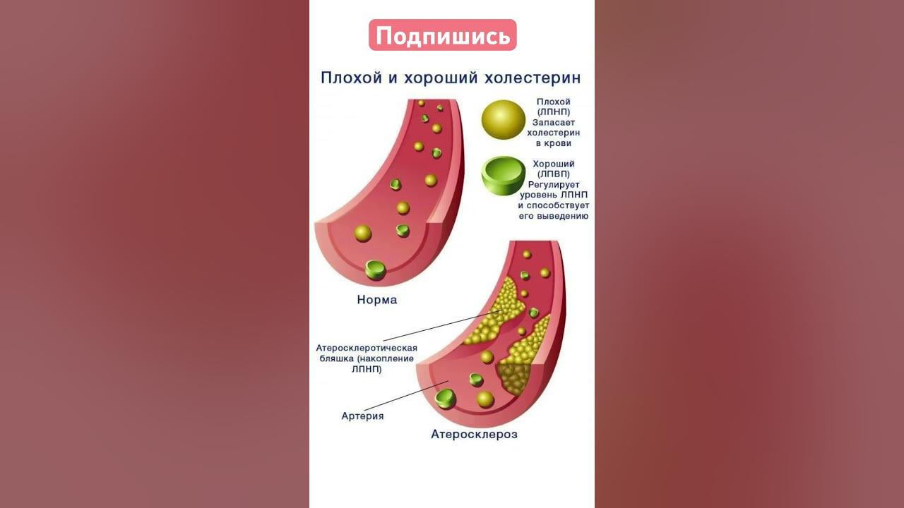 Норма плохого и хорошего холестерина в крови