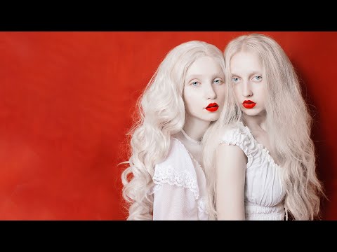 What If Everyone Was Albino?