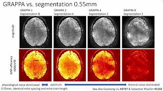 OHBM 2023 | 2848 | Symposium | Laurentius Huber | Cutting-edge methods for cortical-depth-dependen… screenshot 1