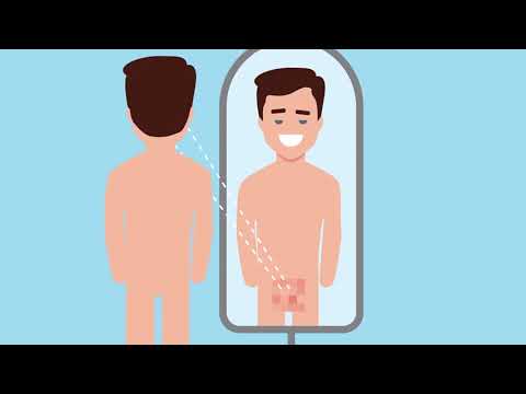 Video: Způsobuje spermatokéla bolest?