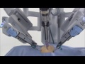 da Vinci® Robotic Surgical System