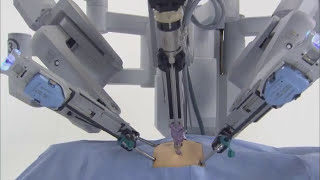 da Vinci® Robotic Surgical System