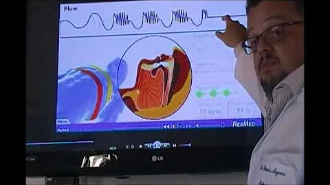 É a principal causa de morte súbita em adultos jovens?