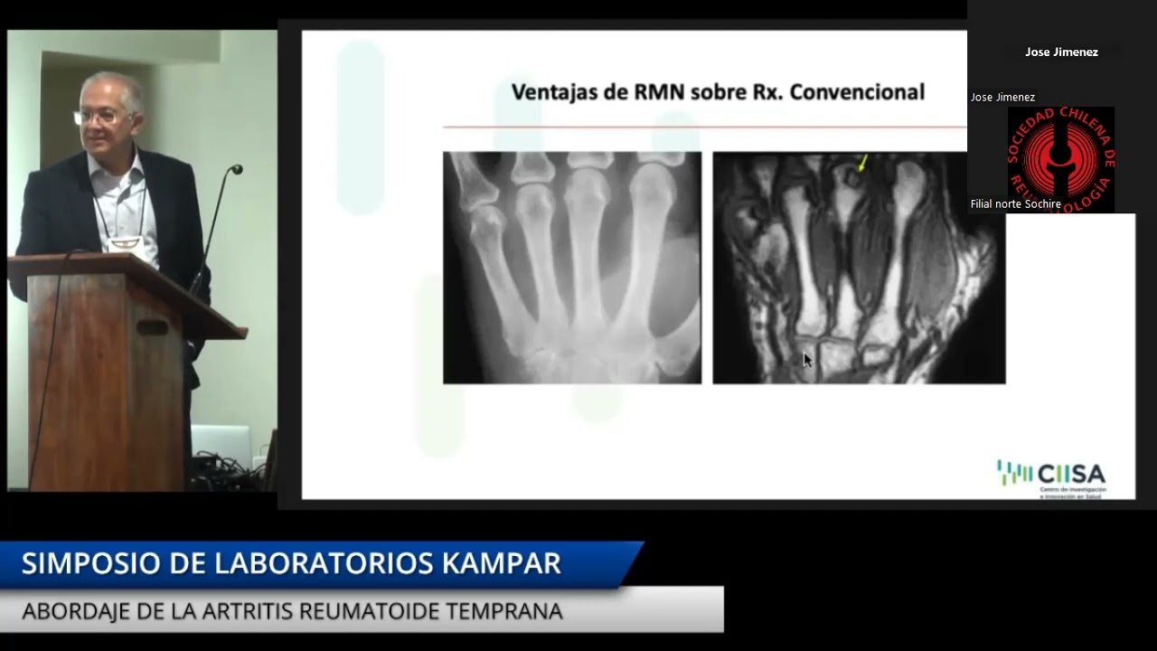 Urgencias en Reumatologia parte 2