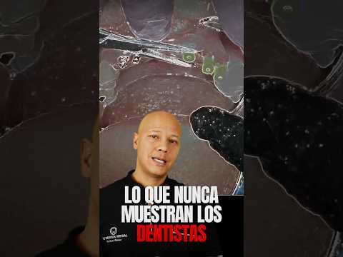 PARECE UN MILAGRO