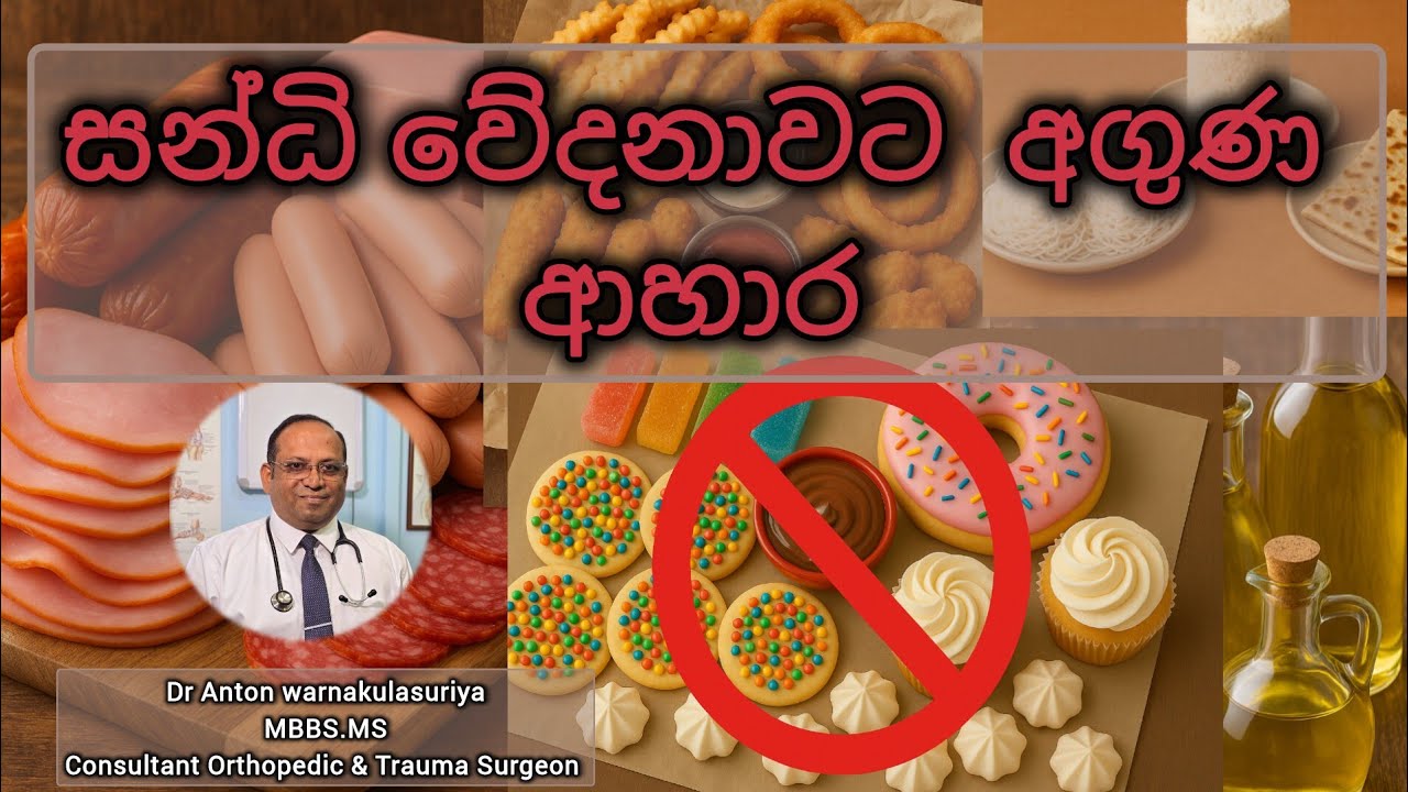 සන්ධි වේදනාවට අගුණ ආහාර. Worst foods for arthritis, Handi vedanavata  aguna aahara