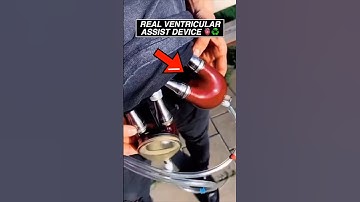 A REAL look at a working ventricular assist device (LVAD) #cardiology #heart #health #transplants