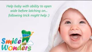 Infant Frenectomy - Aftercare - Part 3 -  Suck Training and Habilitation