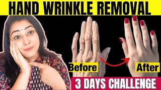 Remove Wrinkles from Hands | Make your Hands Look 10 Years Younger - Get Baby Soft Hands in 3 Days screenshot 1