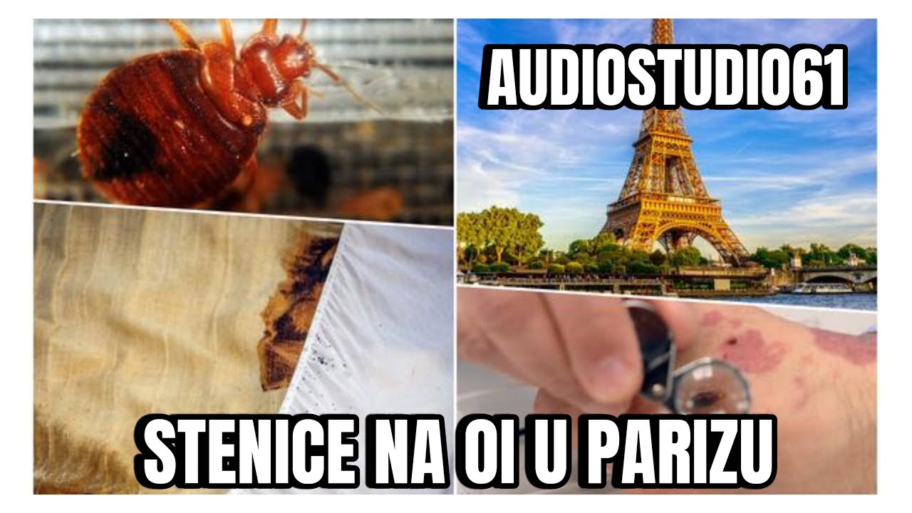 STENICE NA OI U PARIZU