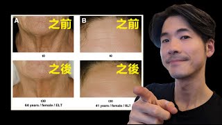 照這種光反轉年齡、拯救長期老化皮膚【免費專業級冰人呼吸運動課程】