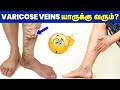 Varicose veins disease in detail  ibc health