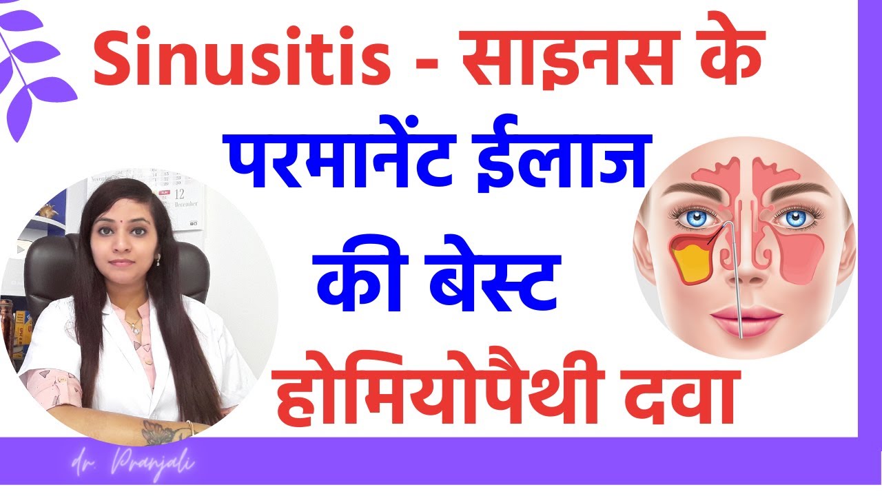 Sinusitis symptoms, causes & treatment by best homeopathic medicines