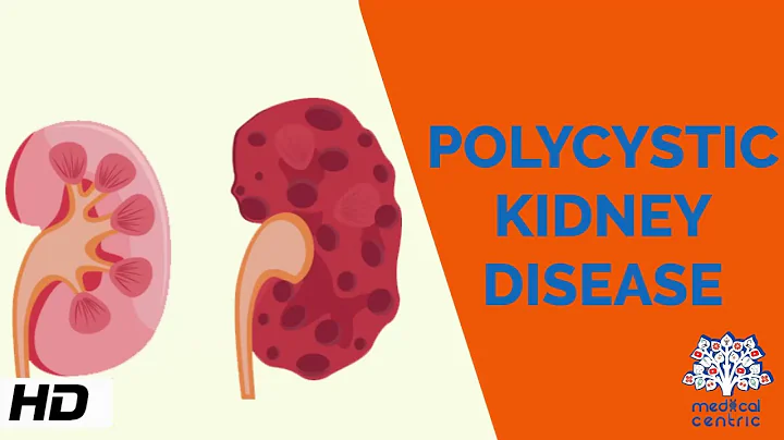 Polycystic kidney Disease, Causes, Signs and Symptoms, Diagnosis and Treatment. - DayDayNews