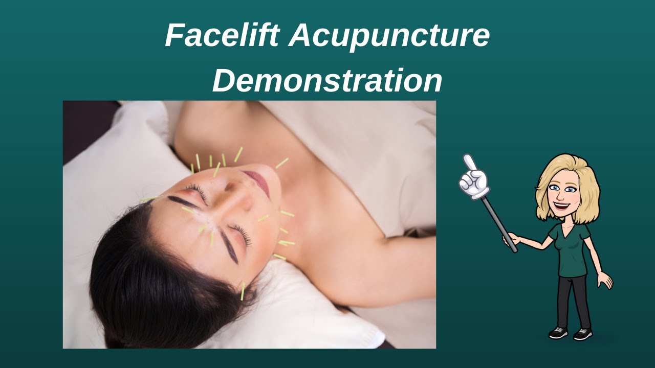 FACELIFT ACUPUNCTURE DEMONSTRATION YouTube