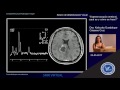 Espectroscopía cerebral, ¿qué es y como se hace?