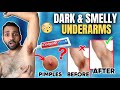 How to stop sweaty  smelly armpits  get rid of dark underarms  underarms hacks  ankit tv