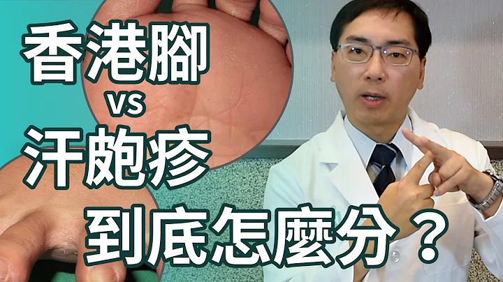 香港腳 vs 汗皰疹，到底怎麼區分？ - 天天要聞