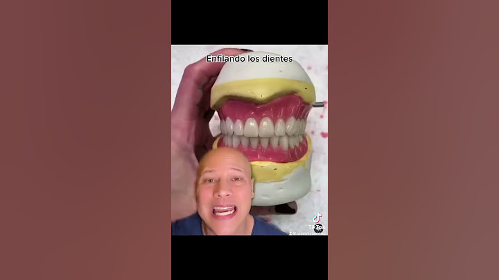 ASÍ SE HACEN LAS PRÓTESIS PARA REPONER TODOS LOS DIENTES.