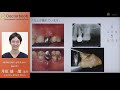 歯周病治療に必要なもの #1：井原雄一郎先生 -Periodontal Therapy