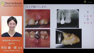 歯周病治療に必要なもの #1：井原雄一郎先生 -Periodontal Therapy