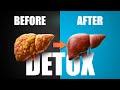 How to detox your liver for fat loss