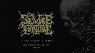 Severe Torture - &quot;The Pinnacle of Suffering&quot; (Official Audio) 2024