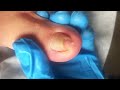 It&#39;s too curly! It&#39;s arched#pedicure | Satisfying video