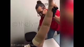 Medias mangas para linfedema - YouTube