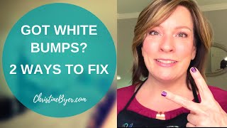 Get Rid Of Milia On The Face