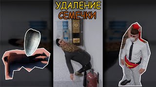 УДАЛЕНИЕ СЕМЕЧКИ из БЕБРЫ от ЧЕКСА)  в GTA 5 RP #shorts