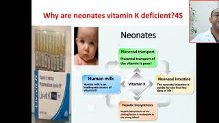 Why are neonates vitamin K deficient? Hemorrhagic disease of newborn, vitamin k deficiency bleeding,