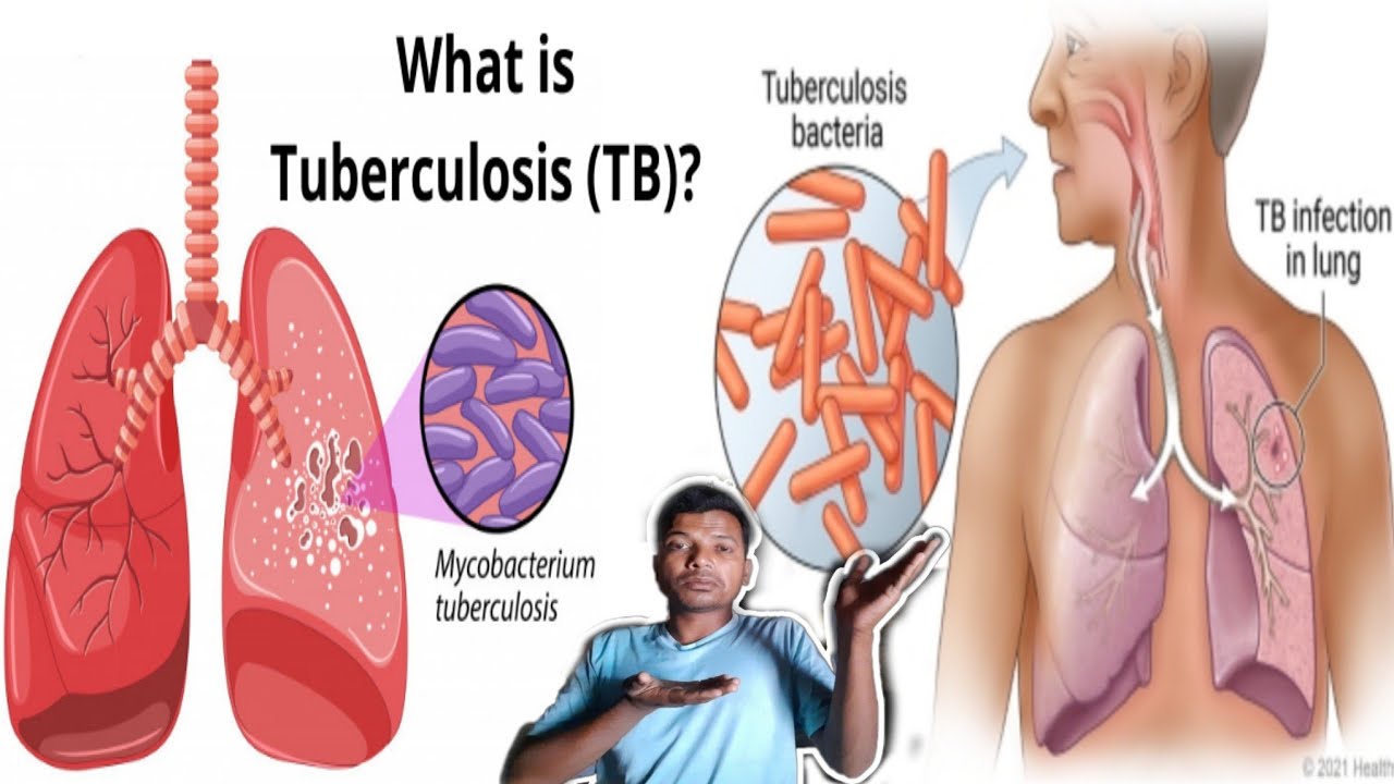 BLOOD TB DB ISL - YouTube