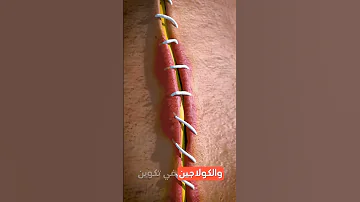 كيف تلتئم الجروح بعد الغرز رحلة الشفاء الكاملة 