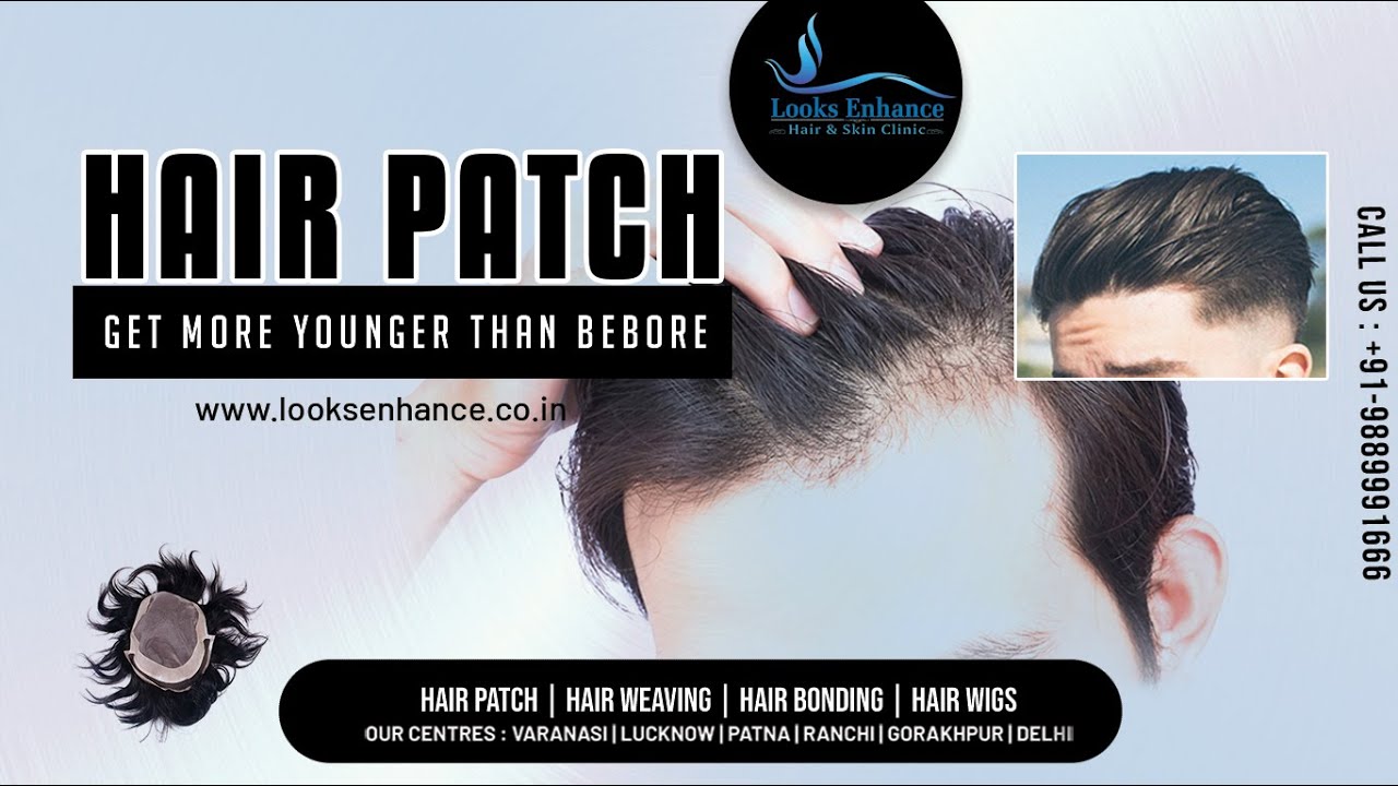 Best Hair Patch in Patna | Hair Weaving in Patna | Hair Patch Centre in  Patna | Call us -9889991666 - YouTube