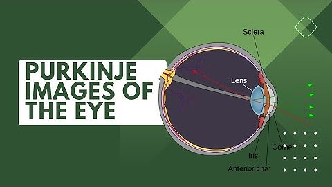 PURKINJE IMAGES | Optics of the Eye | Bsc Optometry course
