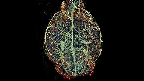 Imaging inside the body: Centre for Advanced Biomedical Imaging at Royal Soc Summer Exhibition 2014