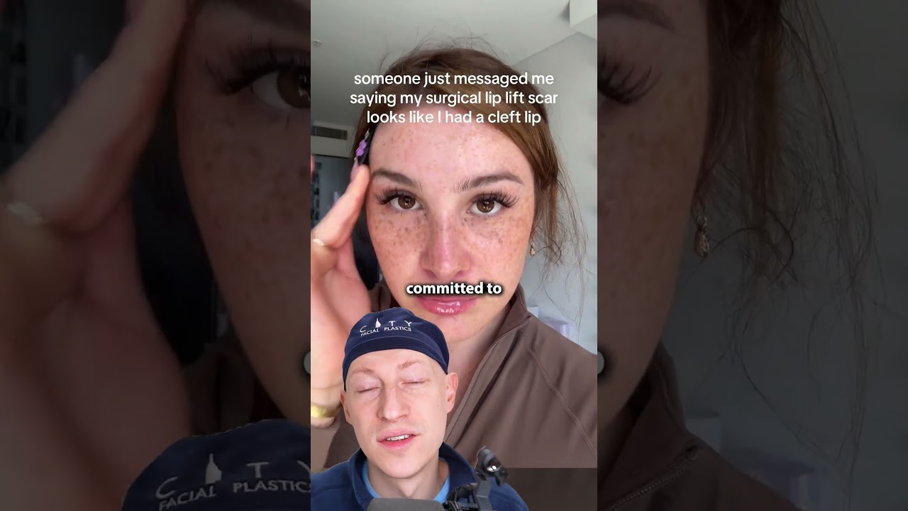 Surgical Lip Lift SCARRING | Plastic Surgeon Reacts