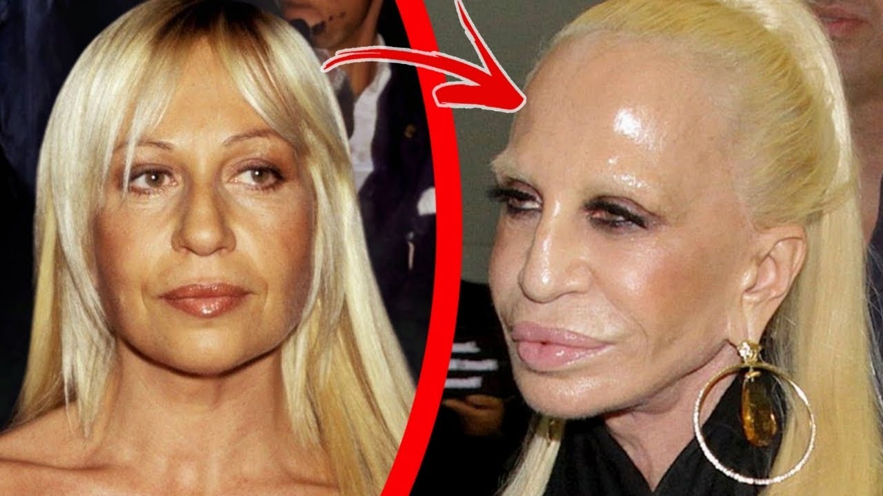 Celebrities That Look Insane After BOTCHED Plastic Surgery - YouTube