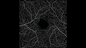 Dataset: relative growing