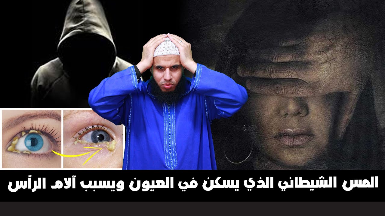 المس الشيطاني الذي يسكن في العيون ويسبب آلام الرأس