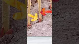 Hair Follicles Under Microscope