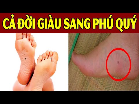 Video: Tại Sao Ruồi Chà Vào Bàn Chân Của Chúng?