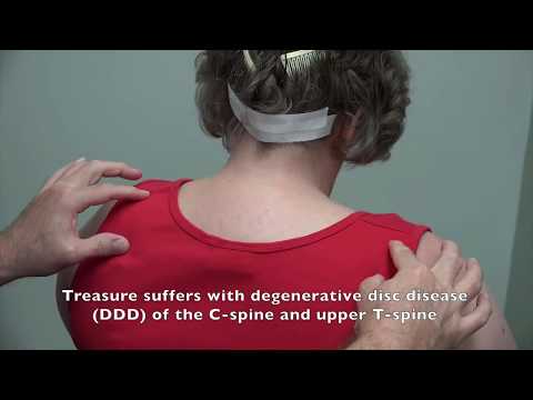 Trigger Point Injections For Treasure's Degenerative Discs