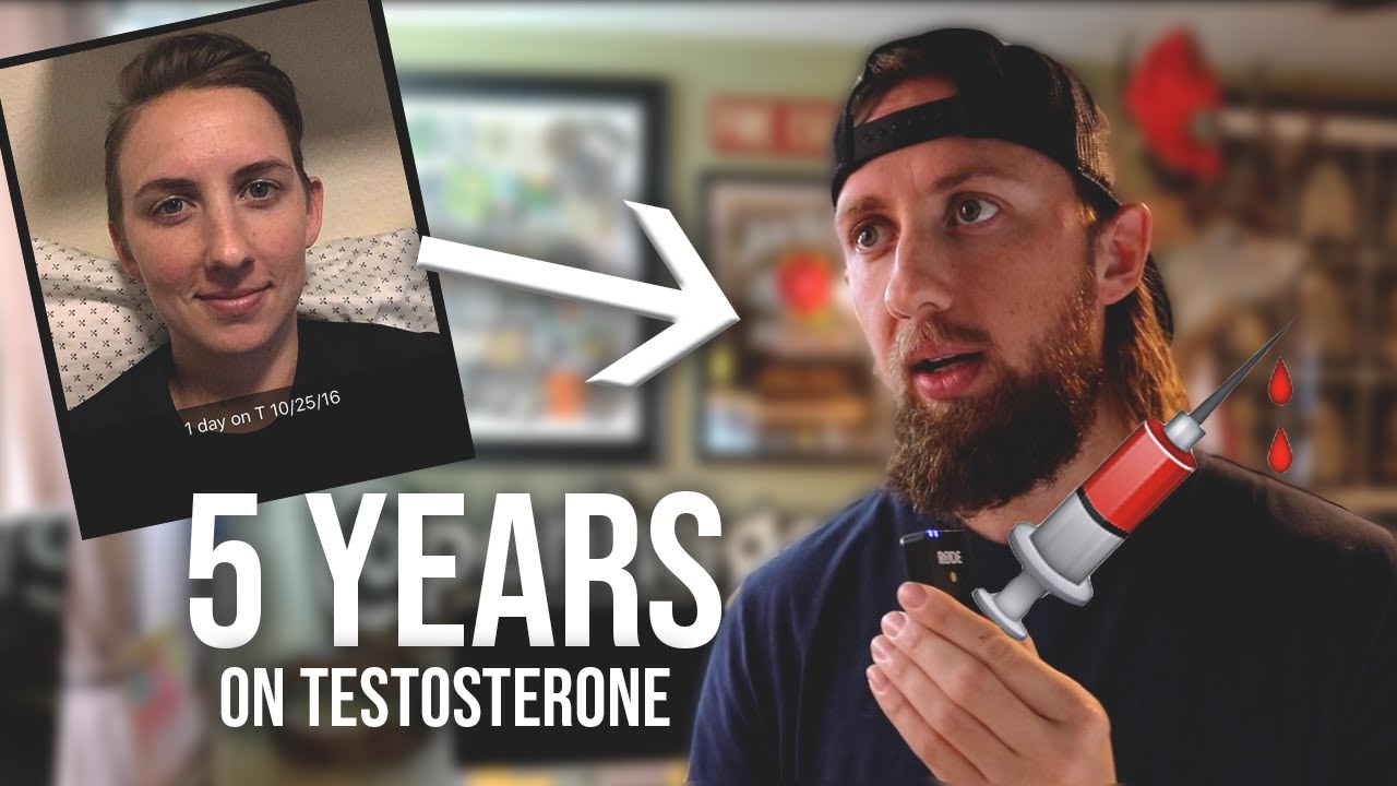 How To Start Testosterone Ftm New York