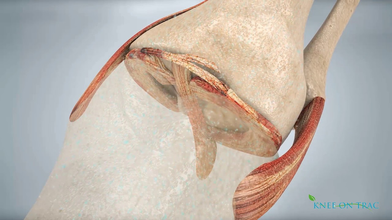 Knee on Trac at Bentley Chiropractic Wellness Center in Rock Hill, SC