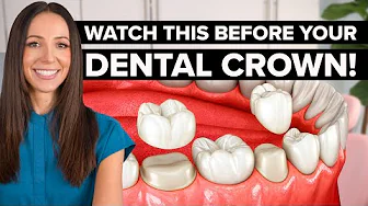 What REALLY Happens at a Dental Crown Appointment (Step-by-Step)