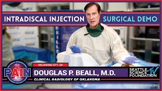 Intradiscal Injection - Douglas P  Beall, M.D.