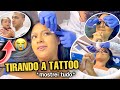 FUI REMOVER MINHA TATUAGEM DO ROSTO COM LASER! *olha como fiquei* 😱